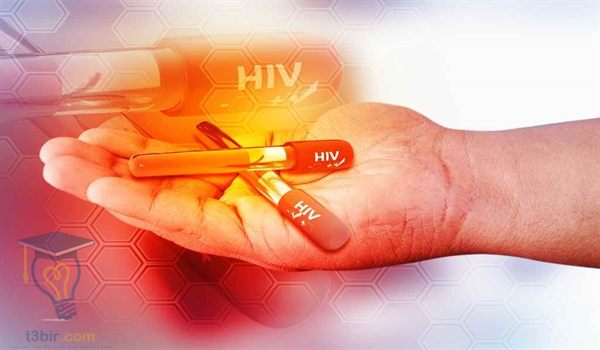 بحث عن الايدز مختصر
